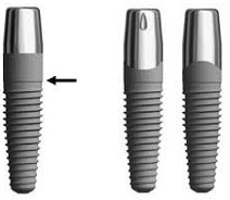 TMJ specialist dentist