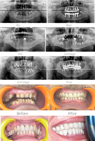 Jaw Joint Pain Treatment,  TMJ specialist dentist